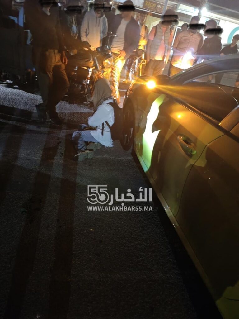 دق ناقوس الخطر: حادثة جديدة لدراجة كهربائية بالعروي تُصيب تلميذة بجروح