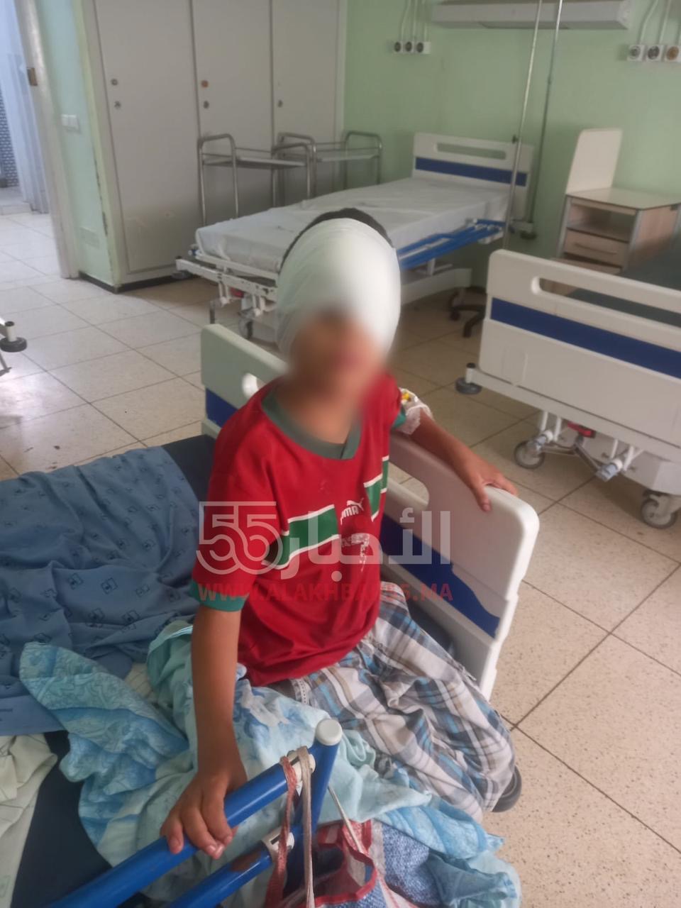 فاجعة مؤلمة.. وفاة طفل من العروي بعد 21 يومًا من تعرضه لعضة كلب ضال بالناظور ومطالب بفتح تحقيق ومحاسبة المسؤولين