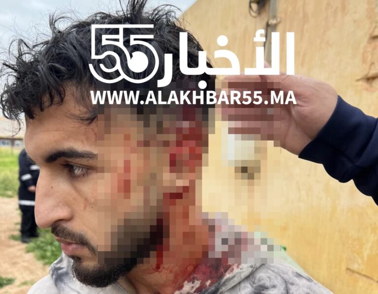 عاجل: اعتداء خطير بسلاح أبيض على لاعب أمل العروي بعد نهاية المباراة
